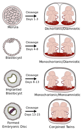 Image credit: https://en.wikipedia.org/wiki/Monoamniotic_twins