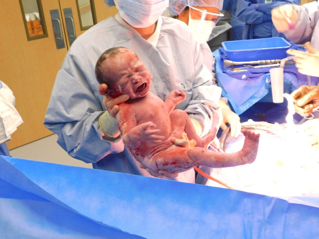 gentle c-section