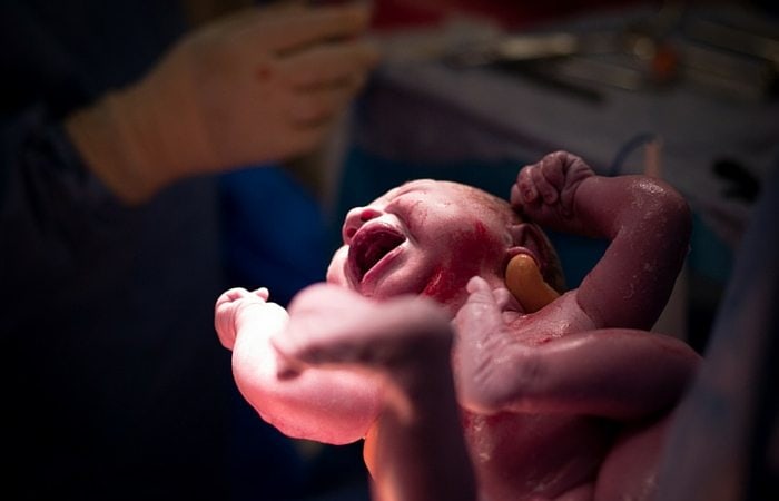 baby born via c-section