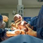 family-centered c-section