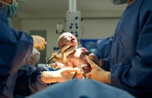 family-centered c-section