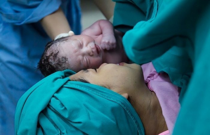 c-section