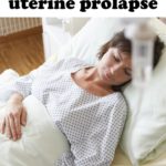 uterine prolapse surgery