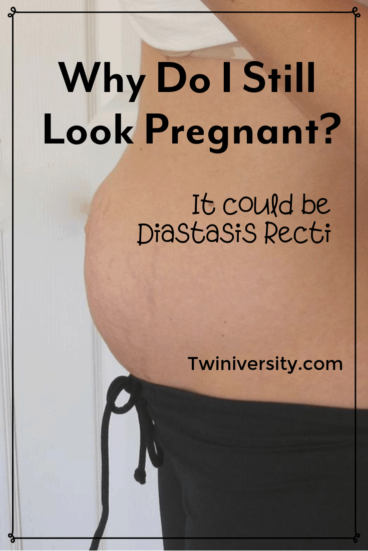 Why Do I Still Look Pregnant It Could Be Diastasis Recti