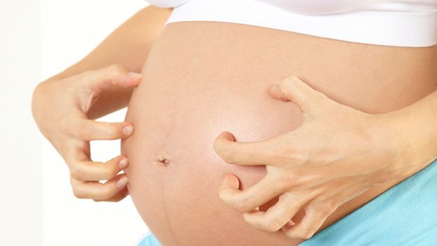 scratching pregnant belly cholestasis