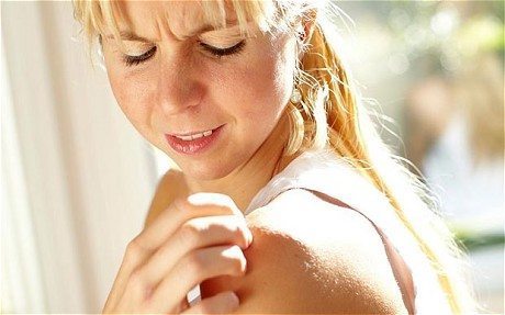woman scratching her shoulder cholestasis