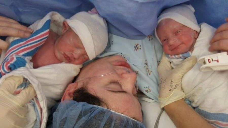 mom holding newborn twins after c-section prep tips 