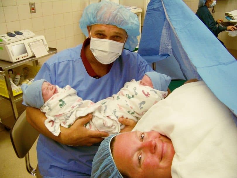 c-section twins after birth