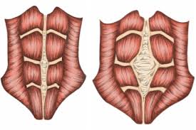 diastasis recti