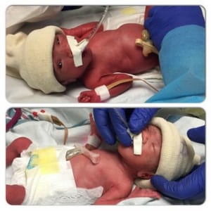 preemie twins