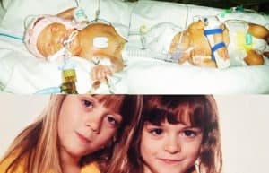 preemie twins