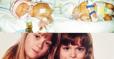 preemie twins