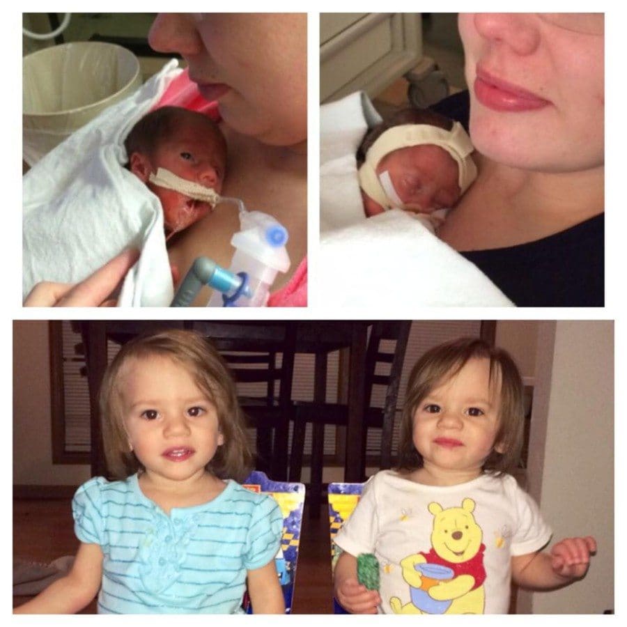 Callie and Kennedy, 2lb, 28 week TTTS and Momo twin survivors!:) They only had a 5% chance to live and spent three months in the nicu.