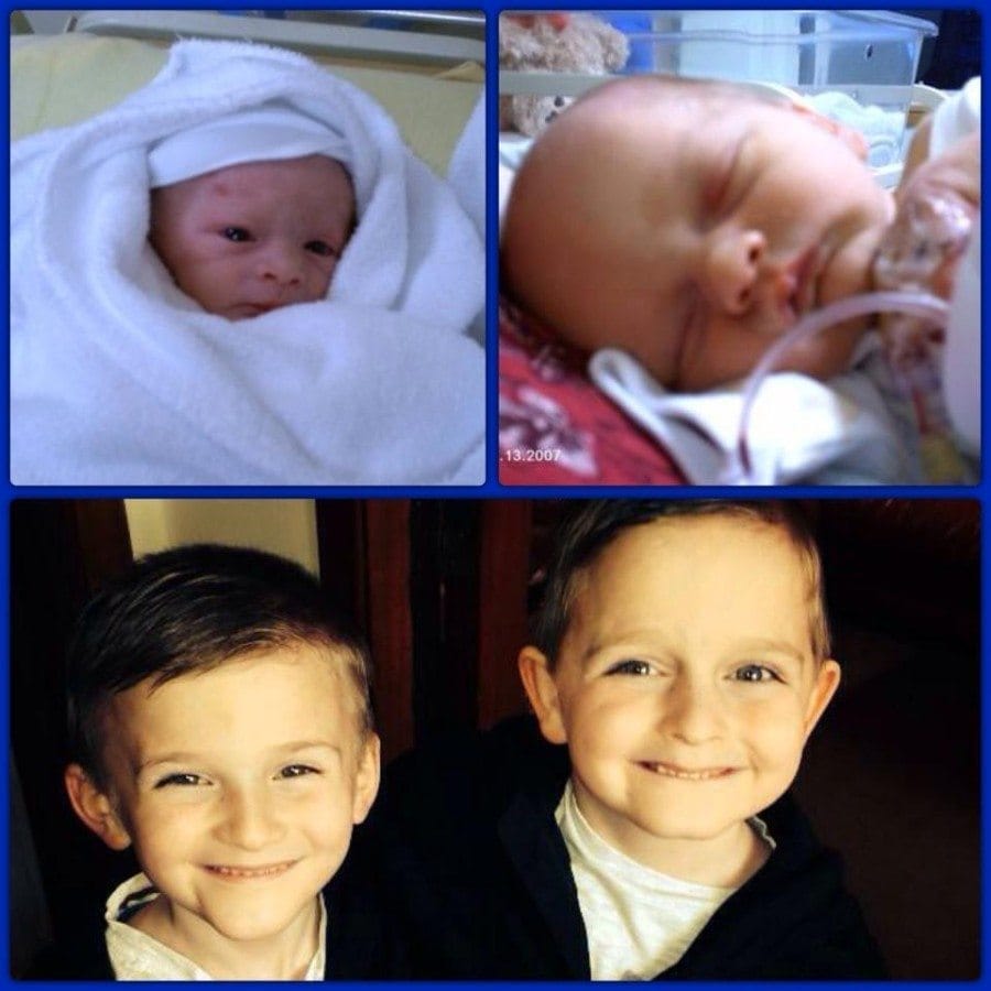 My boys born at 36 wks, smallest of the 2 (left) spent 6 days in scbu, now 7yrs old.