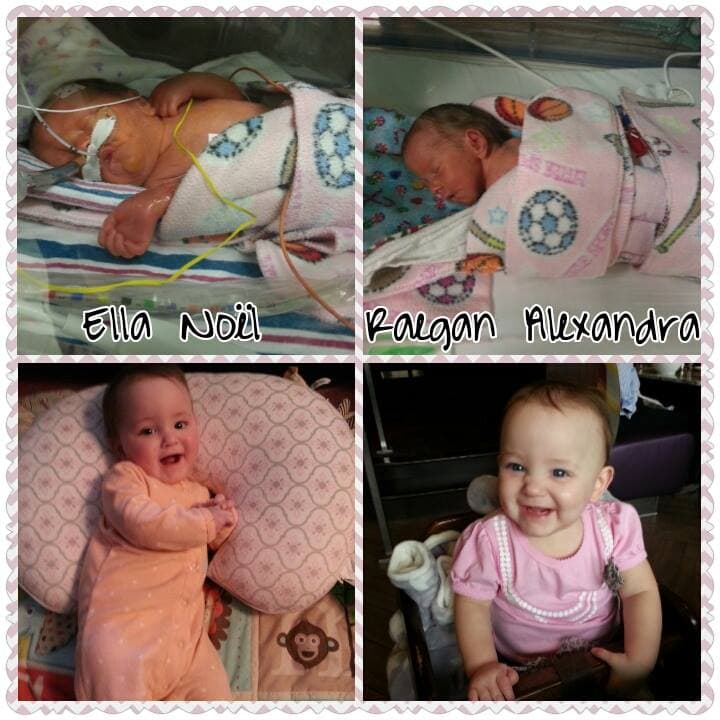 Ella (2 pounds, 10 ounces) and Raegan (2 pounds, 4 ounces) born at 29 weeks, now 8 months corrected were in the NICU 80 days.