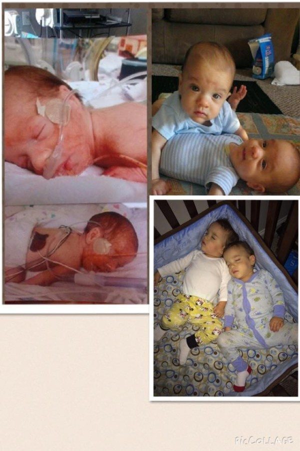 Born at 29 weeks, 11 weeks in the NICU, had minor bilateral hernia surgery, mine are 22 months and going strong!! Reese Michael and Weston Louis. preemie twins