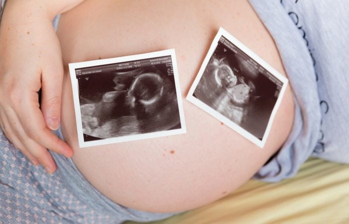 twin ultrasound