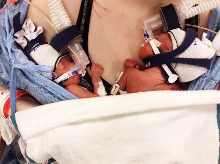 preemie twins in nicu ptsd after the nicu