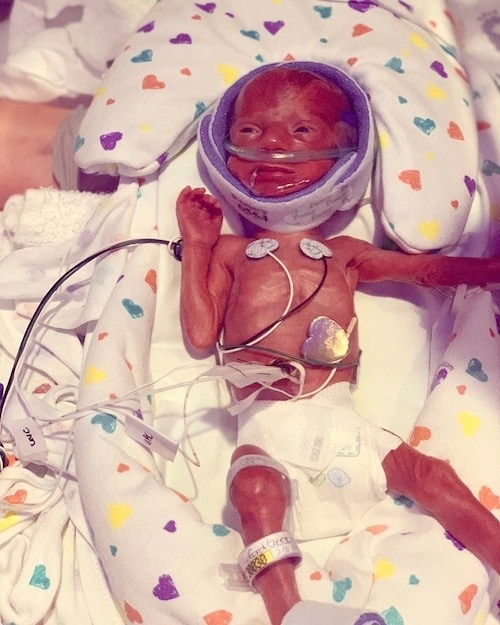 premature baby in NICU signs of preterm labor