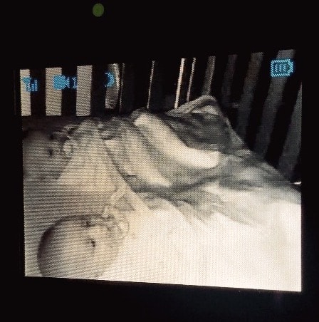 sleep regressions twin babies in a crib on a video monitor