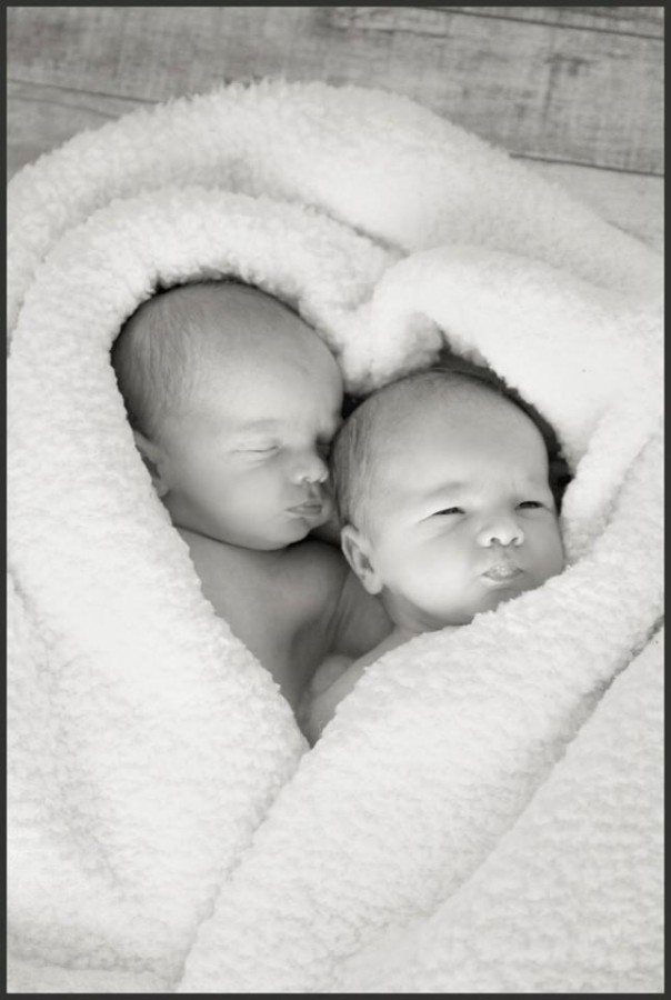 twin infants identical twin pregnancy