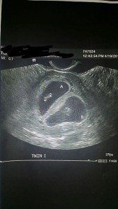 ultrasound6